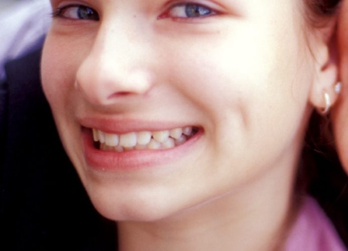 HealthyTeeth2
